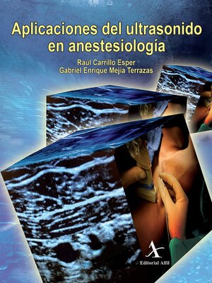 cover image of Aplicaciones del ultrasonido en anestesiología